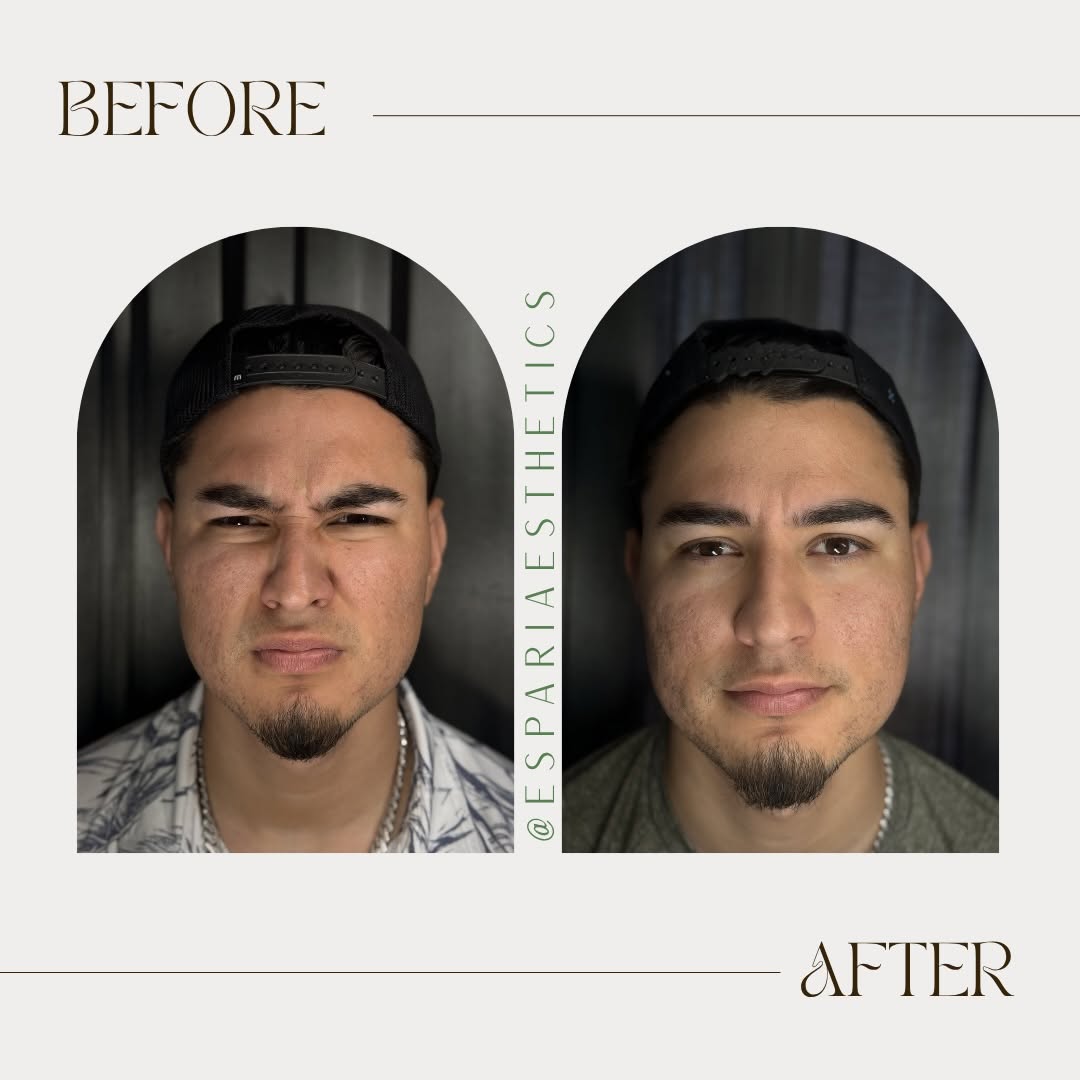 Espari client before-and-after while making an expression